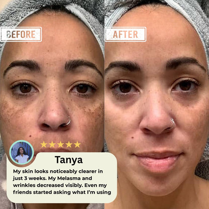 Cevro™ Deep Collagen Silk Peptide Ampoule