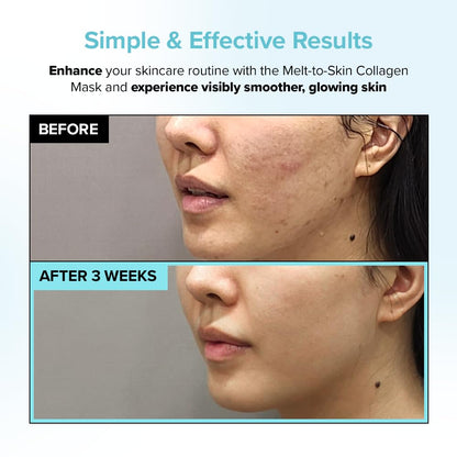 DermaSilk™ Soluble Collagen Lifting Anti-aging Film for Face (Pack of 3)