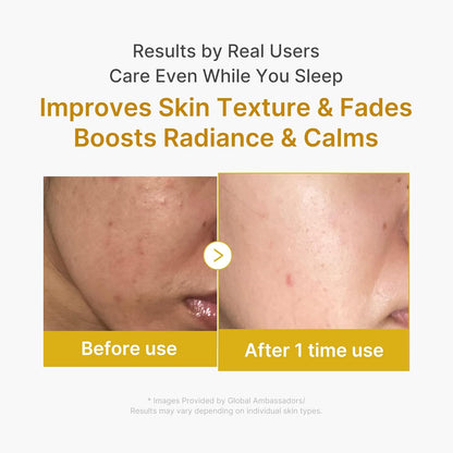 KojicGlow™ - Turmeric Kojic acid Wrapping mask