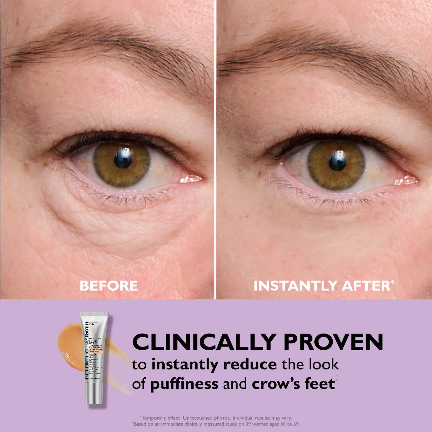 SilkLift Eye™ Instant Firm Eye Tightener