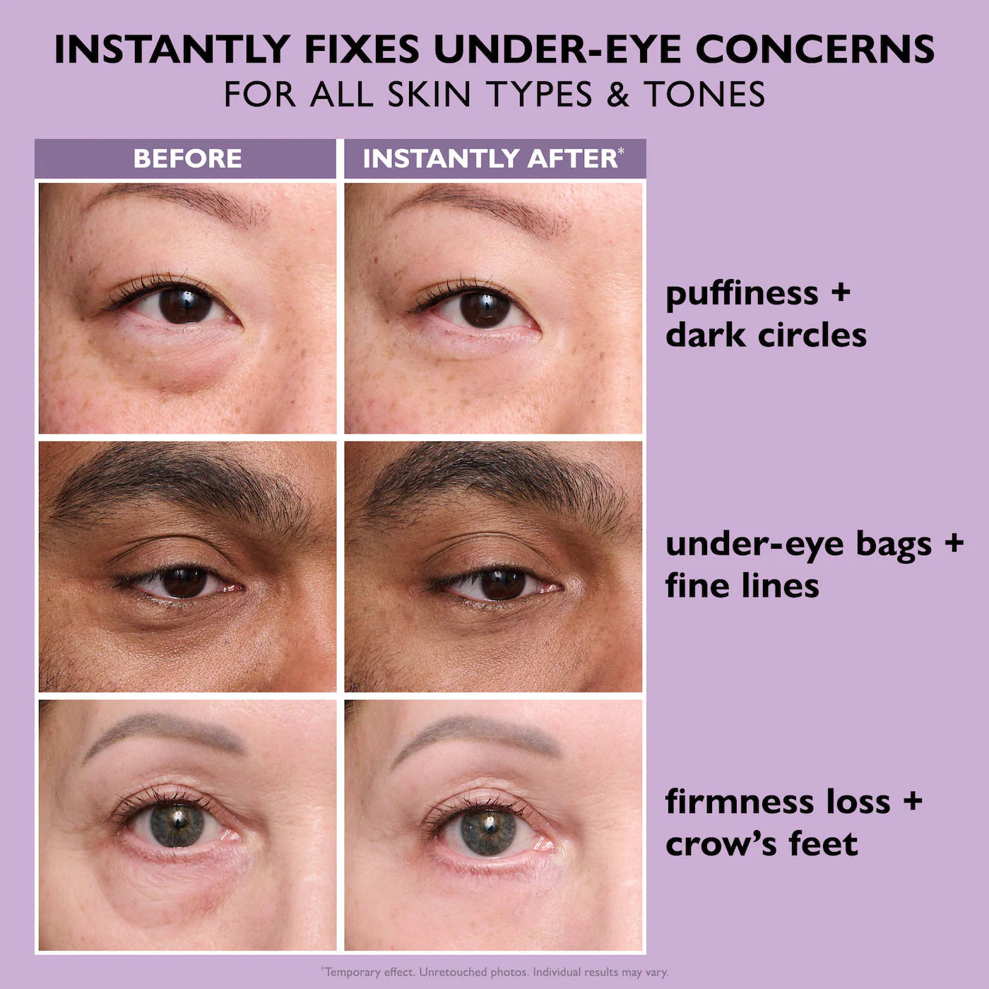 SilkLift Eye™ Instant Firm Eye Tightener